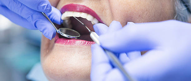 Best Emergency Tooth Extraction in Valle Vista, CA